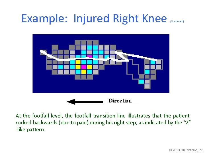 Example: Injured Right Knee (Continued) At the footfall level, the footfall transition line illustrates