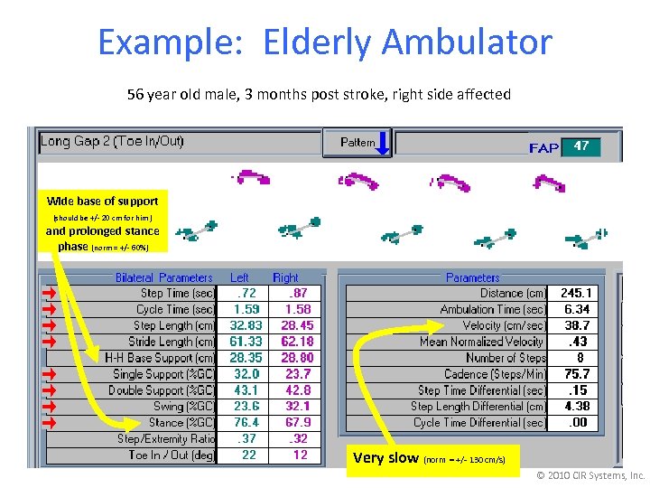 Example: Elderly Ambulator 56 year old male, 3 months post stroke, right side affected