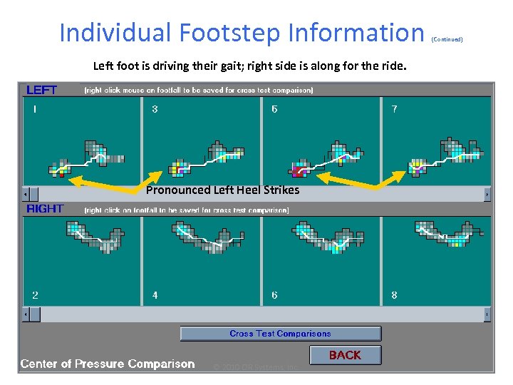 Individual Footstep Information Left foot is driving their gait; right side is along for