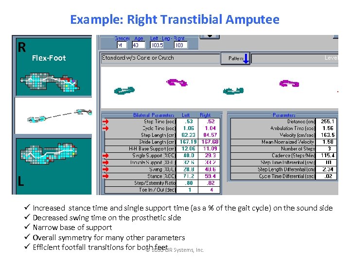 Example: Right Transtibial Amputee R Flex-Foot L ü Increased stance time and single support