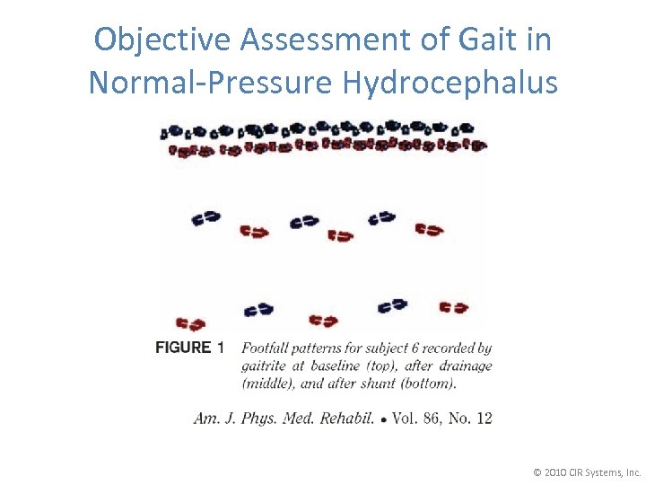 Objective Assessment of Gait in Normal-Pressure Hydrocephalus © 2010 CIR Systems, Inc. 