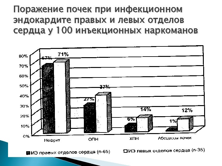 Поражение почек при инфекционном эндокардите правых и левых отделов сердца у 100 инъекционных наркоманов
