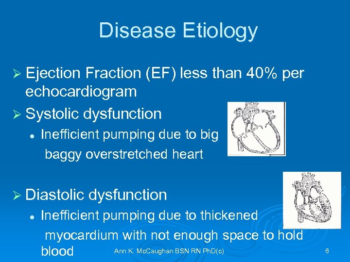 Disease Etiology Ø Ejection Fraction (EF) less than 40% per echocardiogram Ø Systolic dysfunction