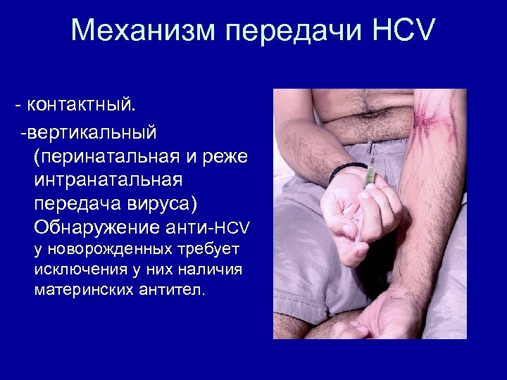 Механизм передачи HCV - контактный. -вертикальный (перинатальная и реже интранатальная передача вируса) Обнаружение анти-HCV