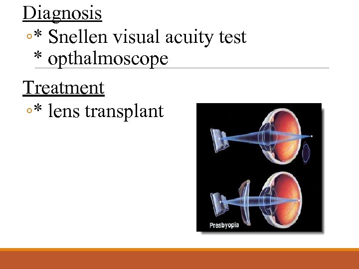 Diagnosis ◦* Snellen visual acuity test * opthalmoscope Treatment ◦* lens transplant 