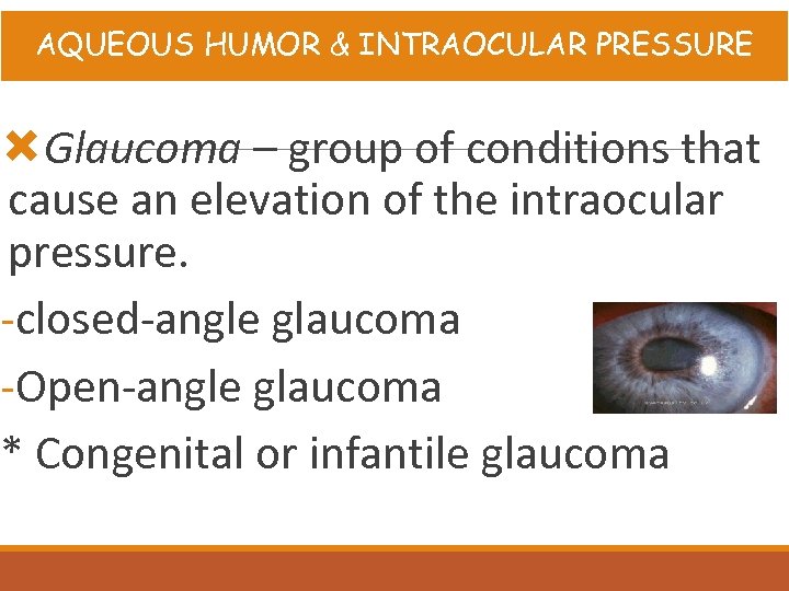 AQUEOUS HUMOR & INTRAOCULAR PRESSURE Glaucoma – group of conditions that cause an elevation