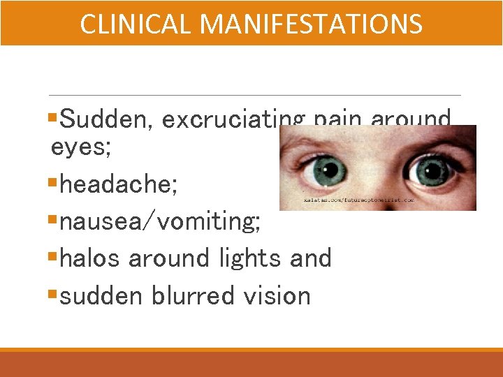 CLINICAL MANIFESTATIONS §Sudden, excruciating pain around eyes; §headache; §nausea/vomiting; §halos around lights and §sudden