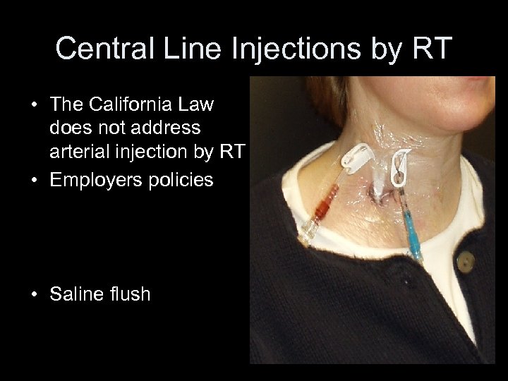 Central Line Injections by RT • The California Law does not address arterial injection