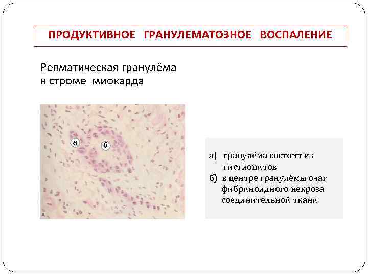 Клиническая картина периферической гигантоклеточной гранулемы характеризуется