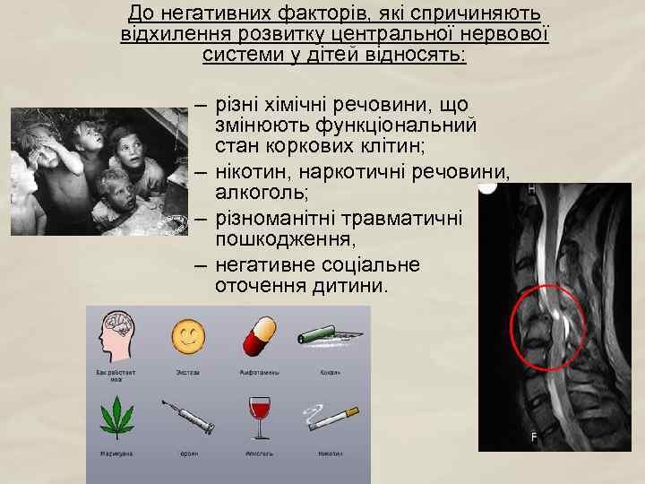 До негативних факторів, які спричиняють відхилення розвитку центральної нервової системи у дітей відносять: –