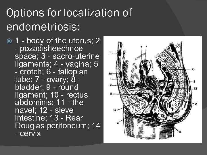 Options for localization of endometriosis: 1 - body of the uterus; 2 - pozadisheechnoe