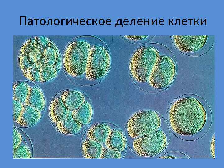 Виды деления клеток. Патологическое деление клеток. Патология деления клетки. Аномалии клеточного деления.