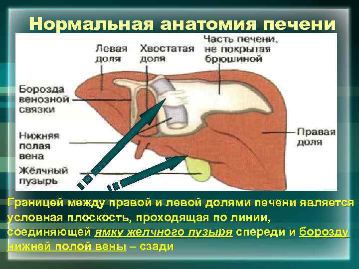 Нормальная анатомия печени Границей между правой и левой долями печени является условная плоскость, проходящая