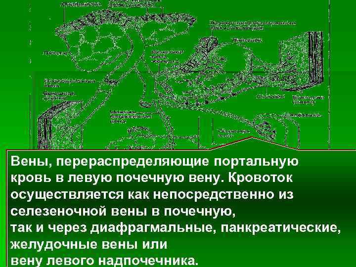 Вены, перераспределяющие портальную кровь в левую почечную вену. Кровоток осуществляется как непосредственно из селезеночной