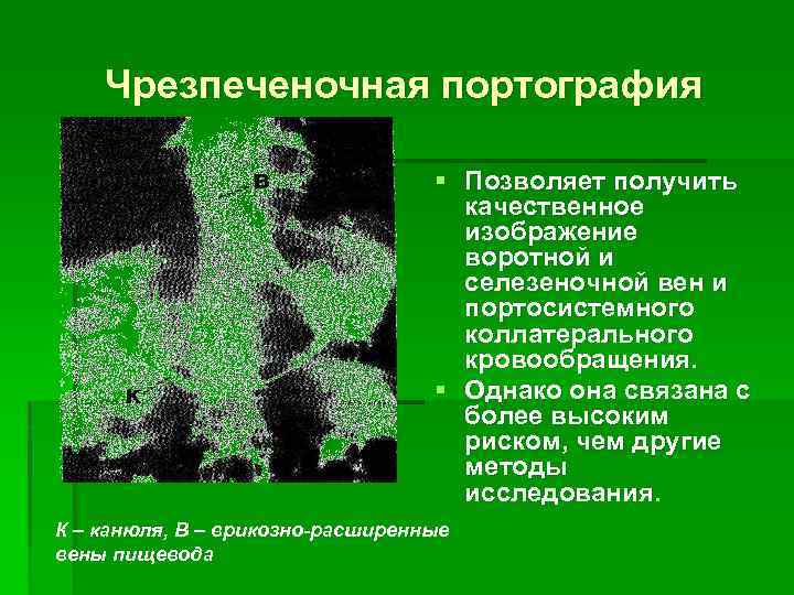 Чрезпеченочная портография § Позволяет получить качественное изображение воротной и селезеночной вен и портосистемного коллатерального