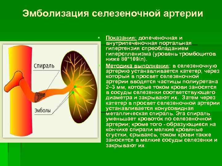 Эмболизация селезеночной артерии § Показания: допеченочная и внутрипеченочная портальная гипертензия спреобладанием гиперспленизма (уровень тромбоцитов