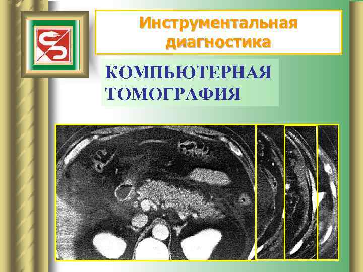 Инструментальная диагностика КОМПЬЮТЕРНАЯ ТОМОГРАФИЯ 