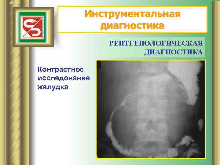 Инструментальная диагностика РЕНТГЕНОЛОГИЧЕСКАЯ ДИАГНОСТИКА Контрастное исследование желудка 