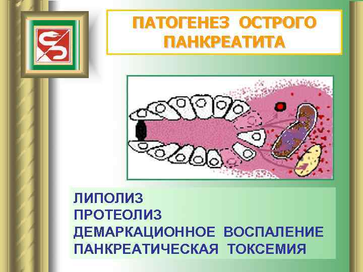 ПАТОГЕНЕЗ ОСТРОГО ПАНКРЕАТИТА ЛИПОЛИЗ ПРОТЕОЛИЗ ДЕМАРКАЦИОННОЕ ВОСПАЛЕНИЕ ПАНКРЕАТИЧЕСКАЯ ТОКСЕМИЯ 