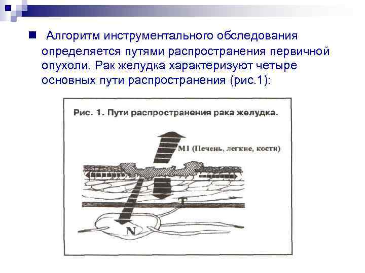 n Алгоритм инструментального обследования определяется путями распространения первичной опухоли. Рак желудка характеризуют четыре основных