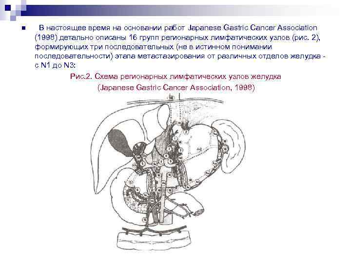 n В настоящее время на основании работ Japanese Gastric Cancer Association (1998) детально описаны