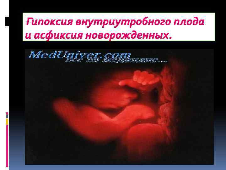 Гипоксия внутриутробного плода и асфиксия новорожденных. 
