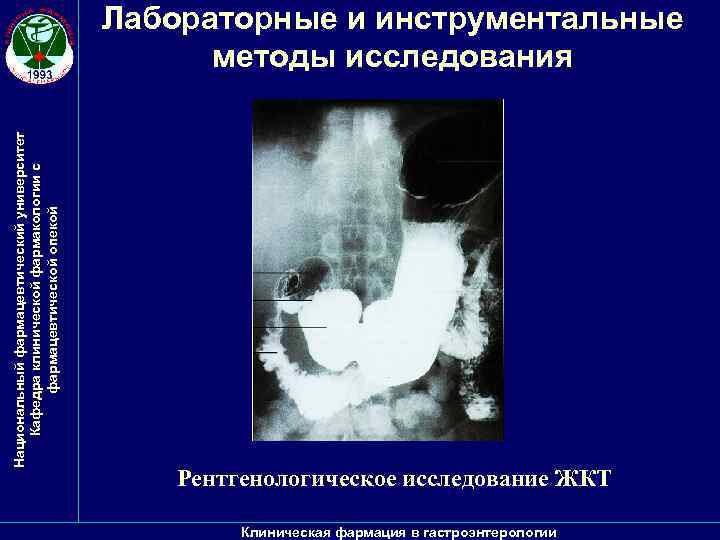 Национальный фармацевтический университет Кафедра клинической фармакологии с фармацевтической опекой Лабораторные и инструментальные методы исследования