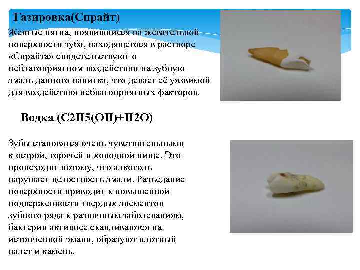 Газировка(Спрайт) Желтые пятна, появившиеся на жевательной поверхности зуба, находящегося в растворе «Спрайта» свидетельствуют о