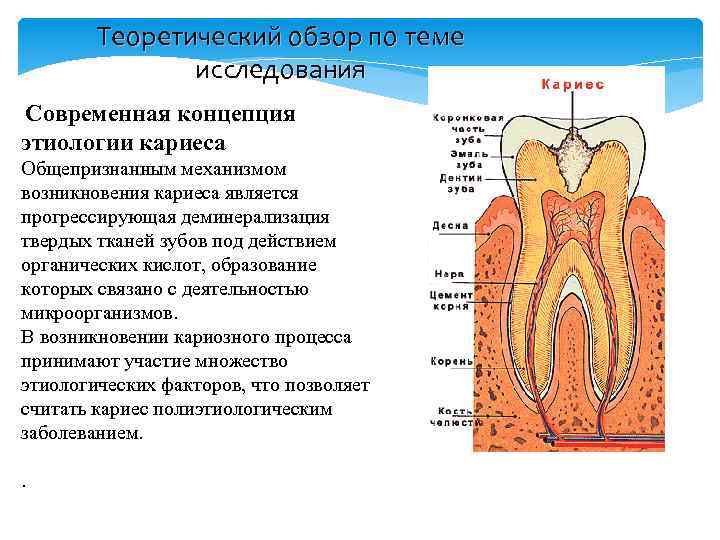 Теоретический обзор по теме исследования Современная концепция этиологии кариеса Общепризнанным механизмом возникновения кариеса является