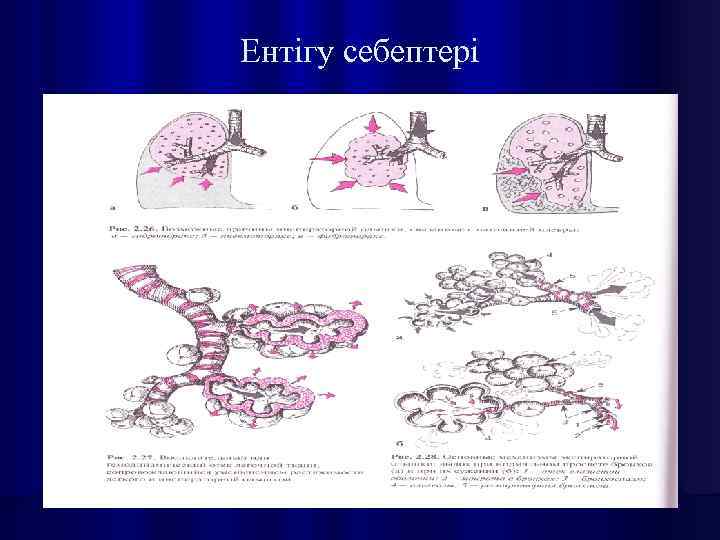 Ентігу себептері 