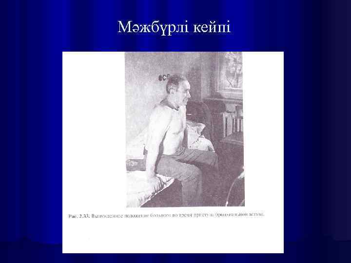 Мәжбүрлі кейпі 