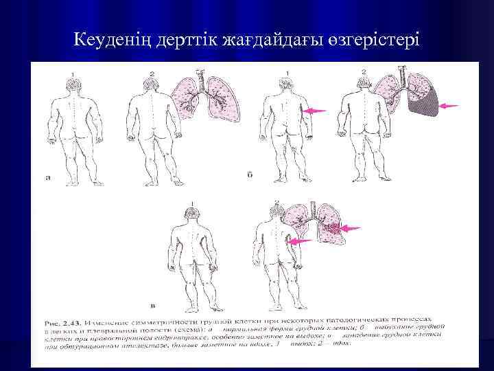 Кеуденің дерттік жағдайдағы өзгерістері 