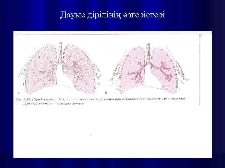 Дауыс дірілінің өзгерістері 