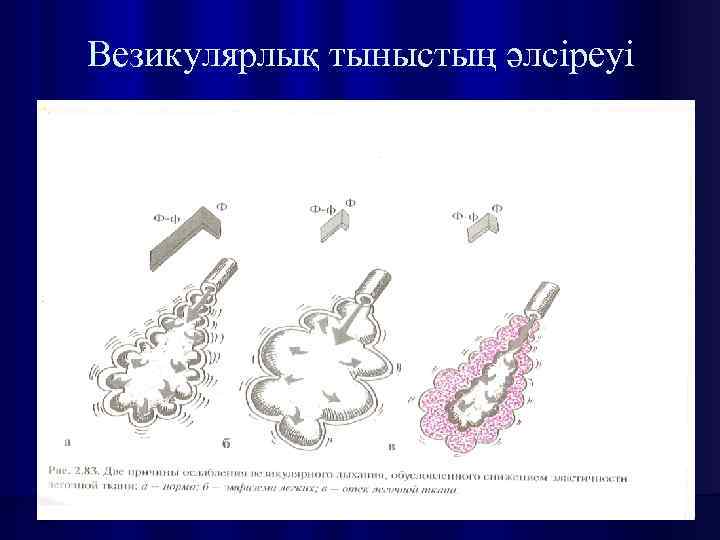 Везикулярлық тыныстың әлсіреуі 