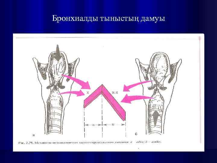 Бронхиалды тыныстың дамуы 