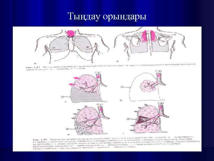 Тыңдау орындары 