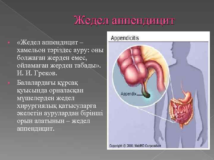 Жедел аппендицит «Жедел аппендицит – хамельон тәріздес ауру: оны болжаған жерден емес, ойламаған жерден