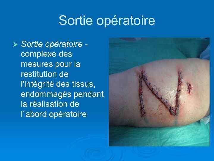 Sortie opératoire Ø Sortie opératoire complexe des mesures pour la restitution de l'intégrité des