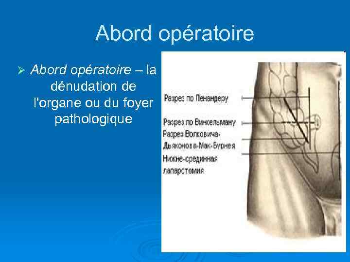 Abord opératoire Ø Abord opératoire – la dénudation de l'organe ou du foyer pathologique
