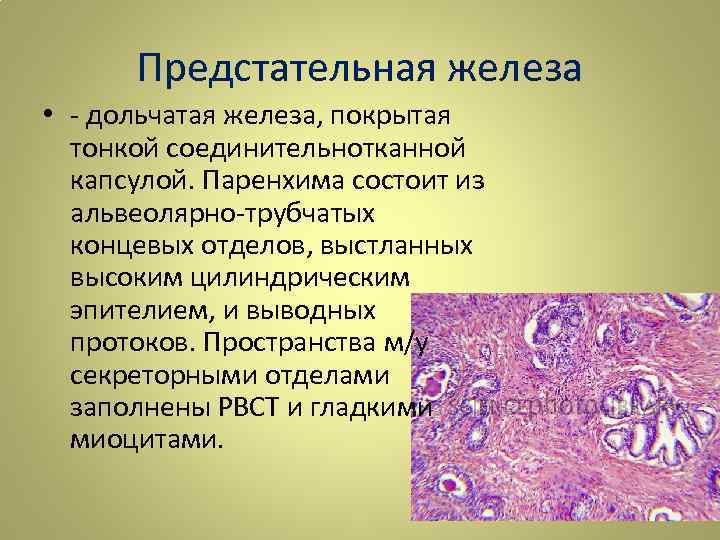 Предстательная железа • - дольчатая железа, покрытая тонкой соединительнотканной капсулой. Паренхима состоит из альвеолярно-трубчатых