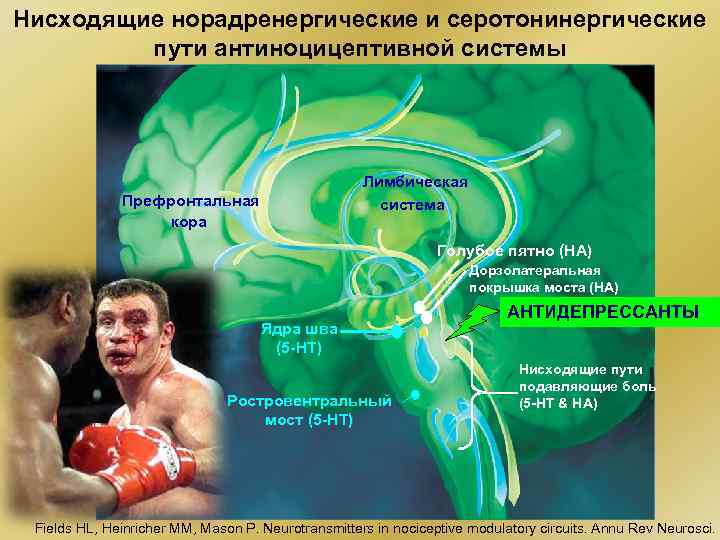 Нисходящие норадренергические и серотонинергические пути антиноцицептивной системы Лимбическая система Префронтальная кора Голубое пятно (НА)