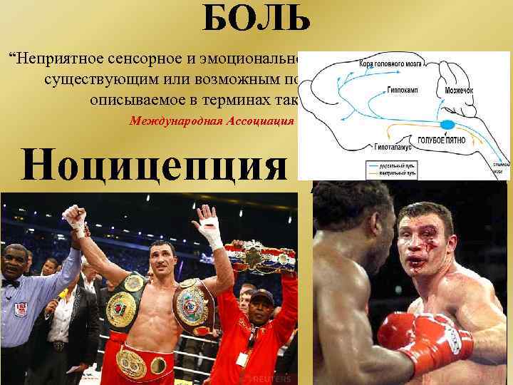 БОЛЬ “Неприятное сенсорное и эмоциональное переживание, связанное с существующим или возможным повреждением ткани или