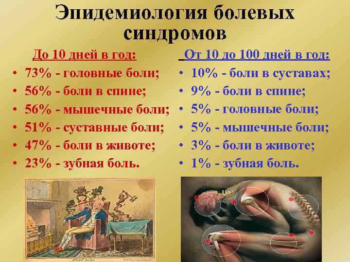 Эпидемиология болевых синдромов От 10 до 100 дней в год: • 73% - головные