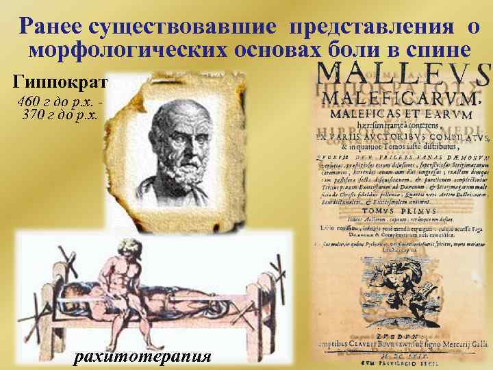 Ранее существовавшие представления о морфологических основах боли в спине Гиппократ 460 г до р.