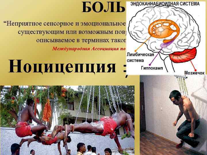 БОЛЬ “Неприятное сенсорное и эмоциональное переживание, связанное с существующим или возможным повреждением ткани или