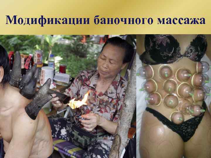 Модификации баночного массажа 