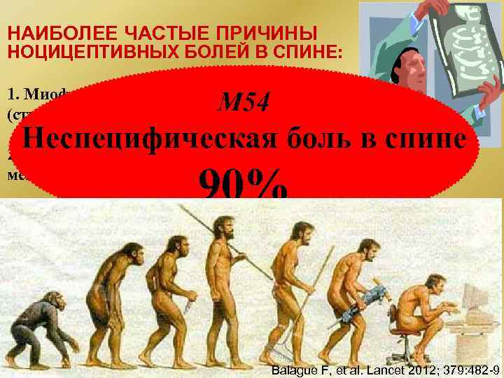 НАИБОЛЕЕ ЧАСТЫЕ ПРИЧИНЫ НОЦИЦЕПТИВНЫХ БОЛЕЙ В СПИНЕ: 1. Миофасциальные боли (страдание мышцы) (первичное М