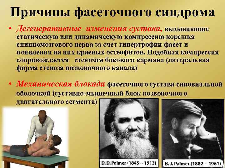 Причины фасеточного синдрома • Дегенеративные изменения сустава, вызывающие статическую или динамическую компрессию корешка спинномозгового