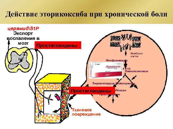 Действие эторикоксиба при хронической боли церамидS 1 P Экспорт воспаления в мозг Простагландины Мембрана