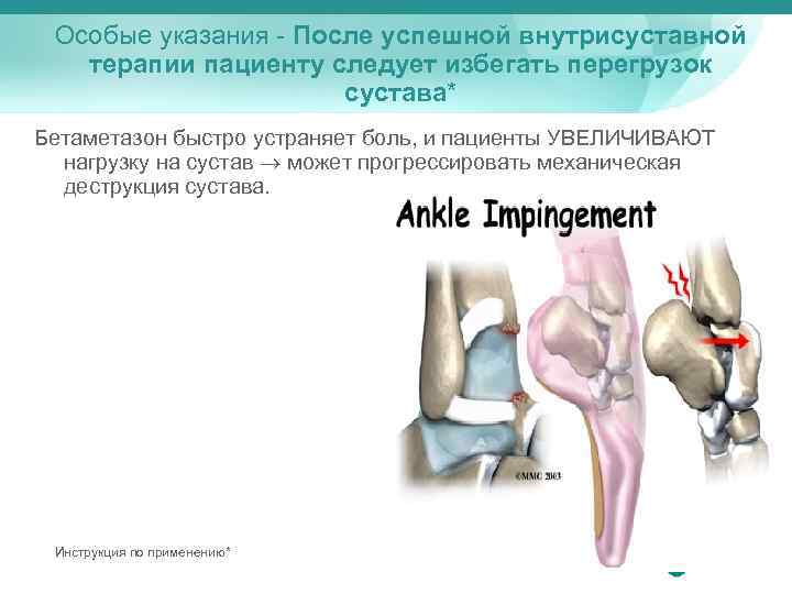 Особые указания - После успешной внутрисуставной терапии пациенту следует избегать перегрузок сустава* Бетаметазон быстро